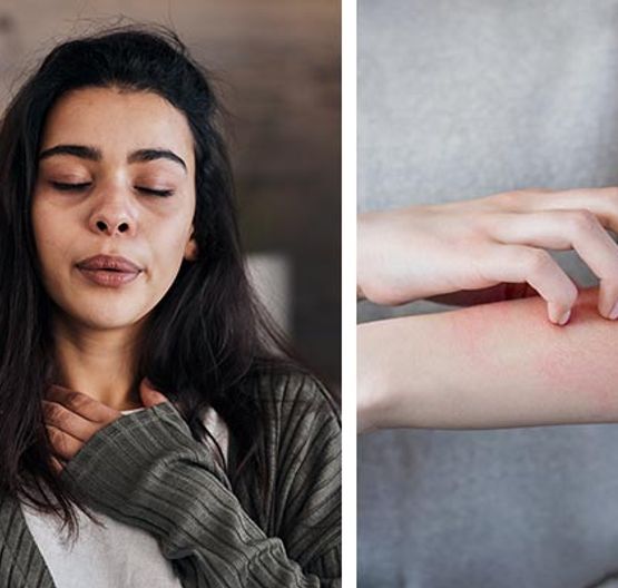 Collage showing breathing issues and allergic skin reactions on hand