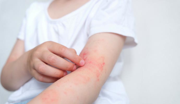 Skin rash on arm Skin rash on arm