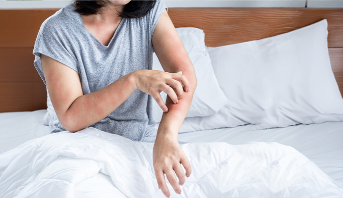 Woman scratching an itchy red rash on her arm